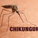 CHIKUNGUNYA