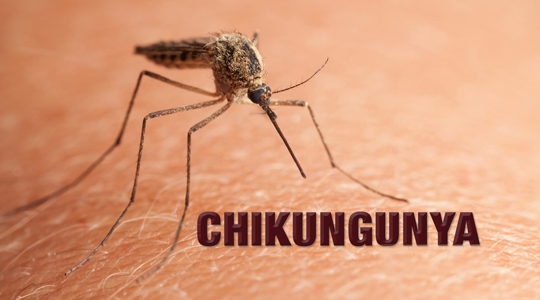 CHIKUNGUNYA