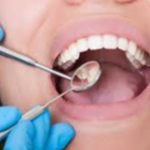 Dental Health